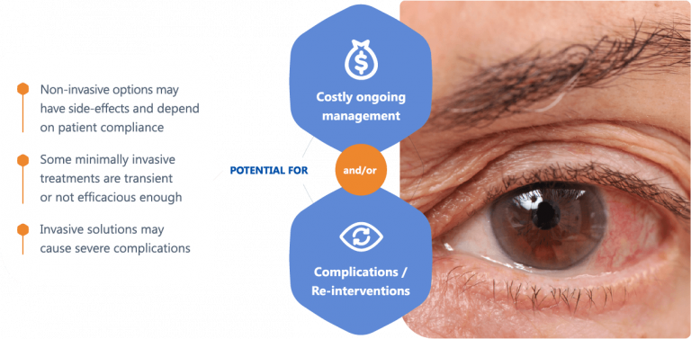 Glaucoma Surgery & Treatments - ISTAR Medical